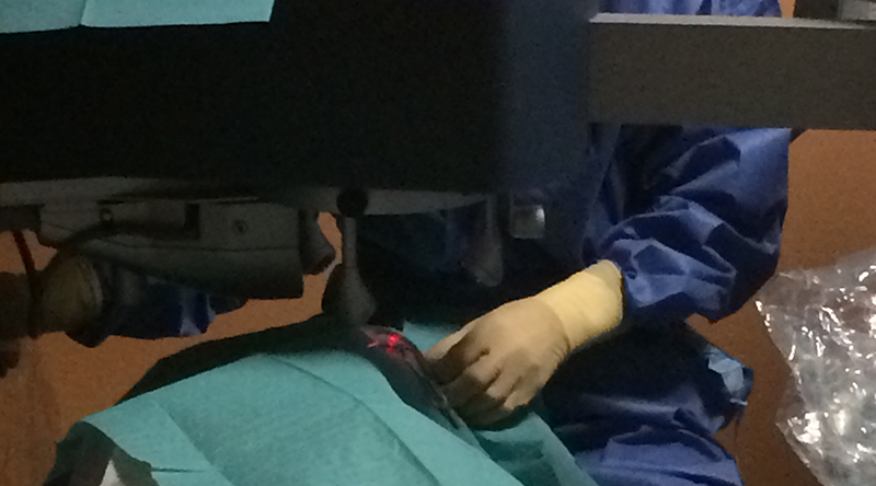 Chirurgie Laser de l'Œil à Biarritz I LuzClinic Côte Basque